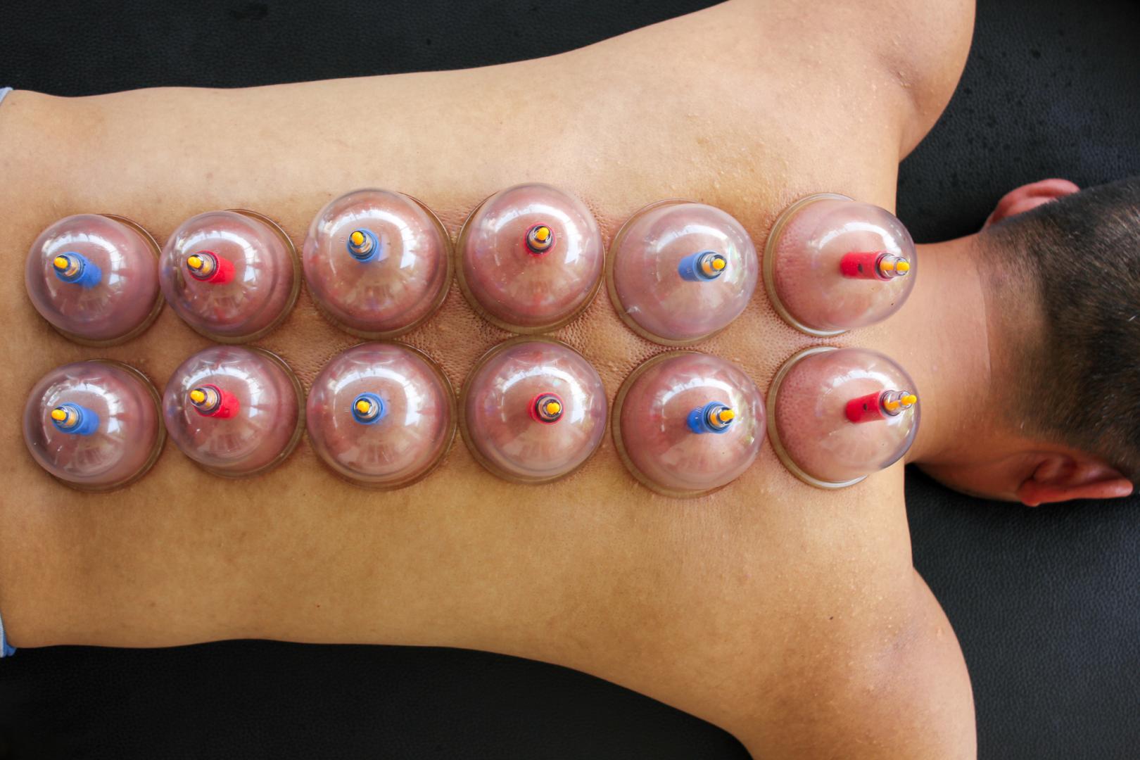 Chinese herbal medicine Templestowe Lower Melbourne